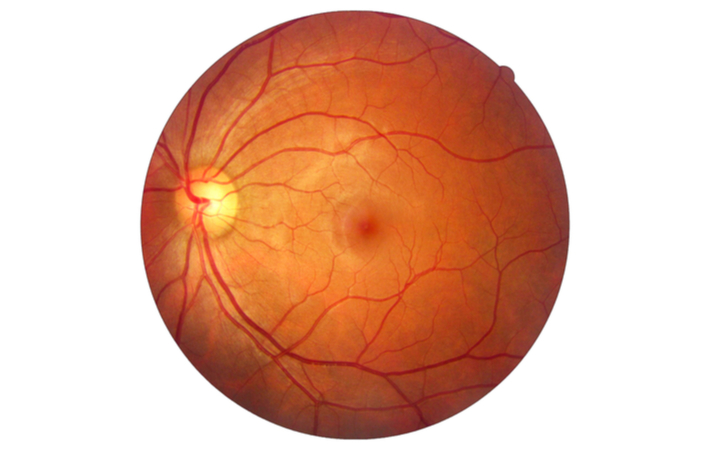 fundus retina